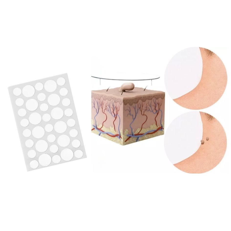 PARCHES ANTI VERRUGAS 108 unidades