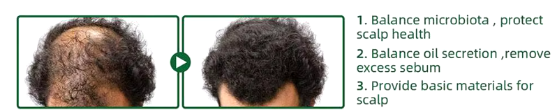 ELHOE CRECIMIENTO PARA EL CABELLO