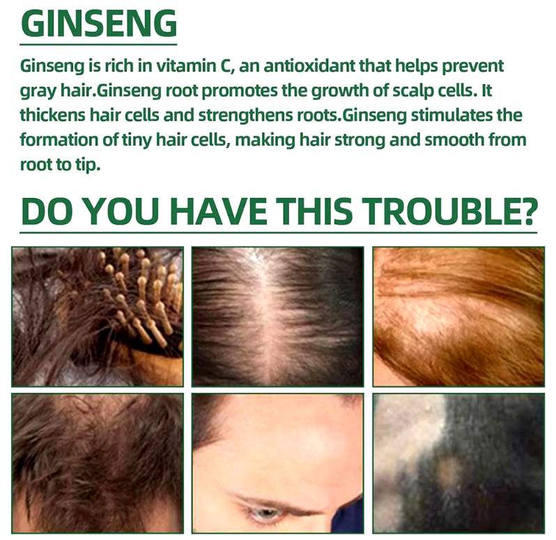 ELHOE CRECIMIENTO PARA EL CABELLO