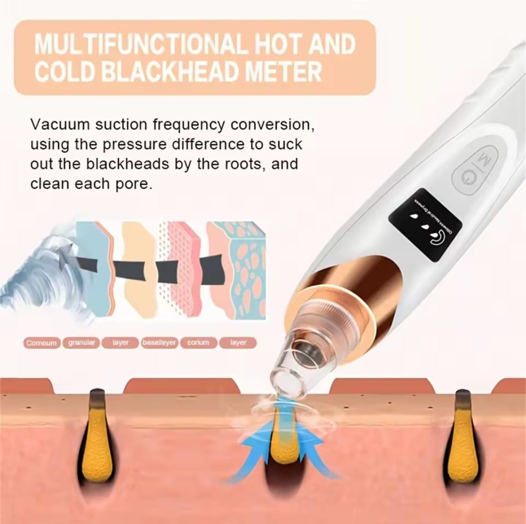 Removedor  de espinillas y limpia poros