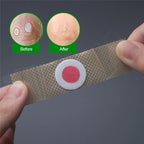 42 PARCHES  PARA CALLOS