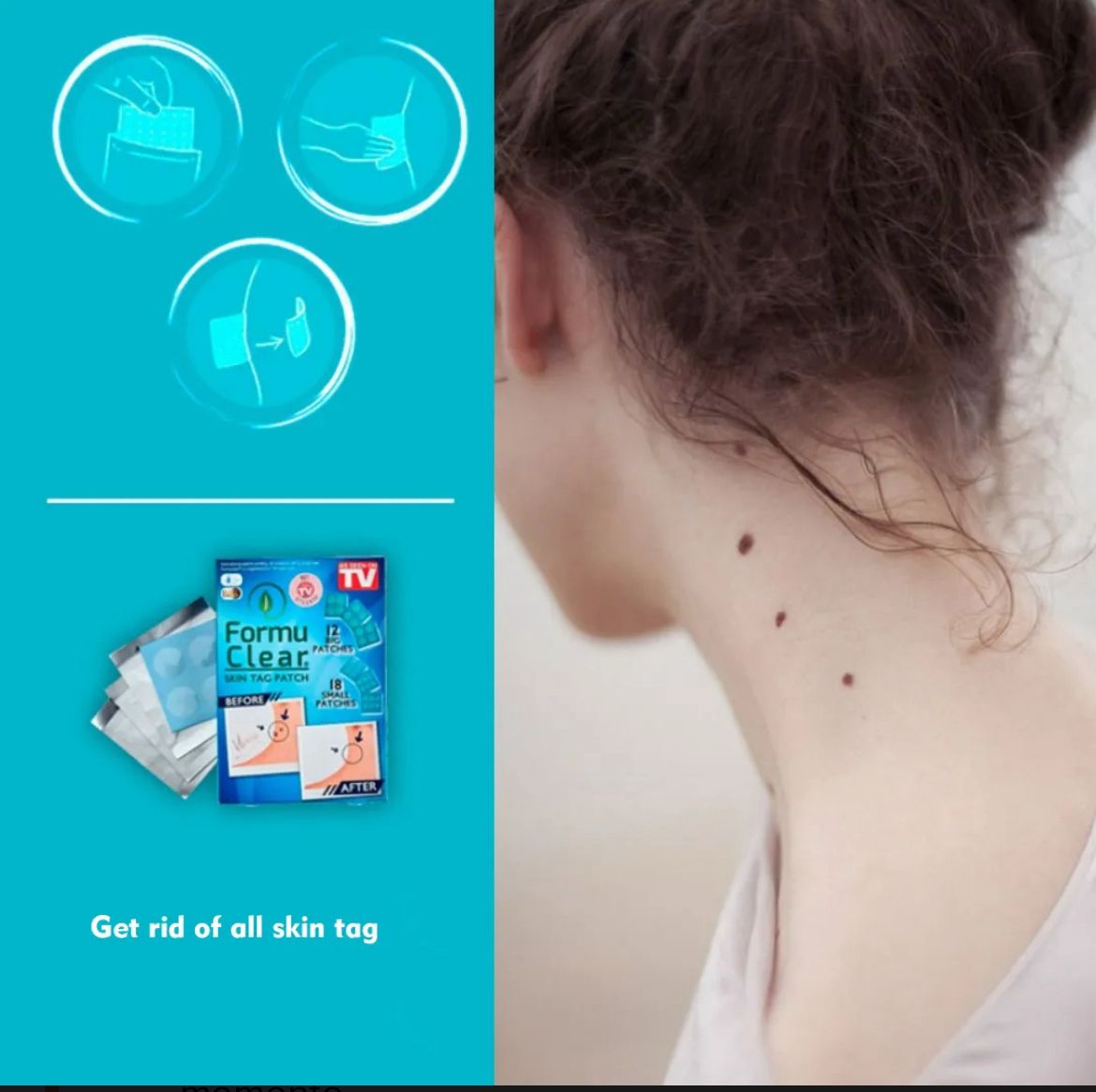 PARCHE ANTI VERRUGAS 108 PZ