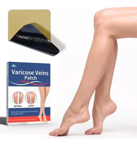 PARCHE PARA VARICES ROYAL PRESTIGE