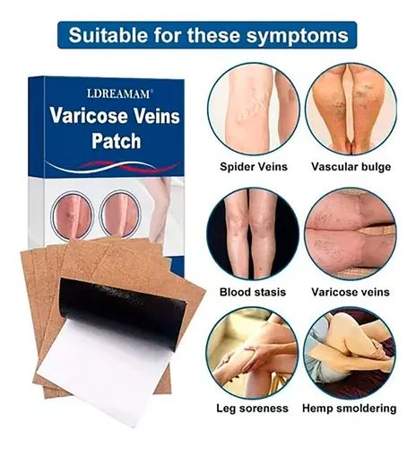 PARCHE PARA VARICES ROYAL PRESTIGE