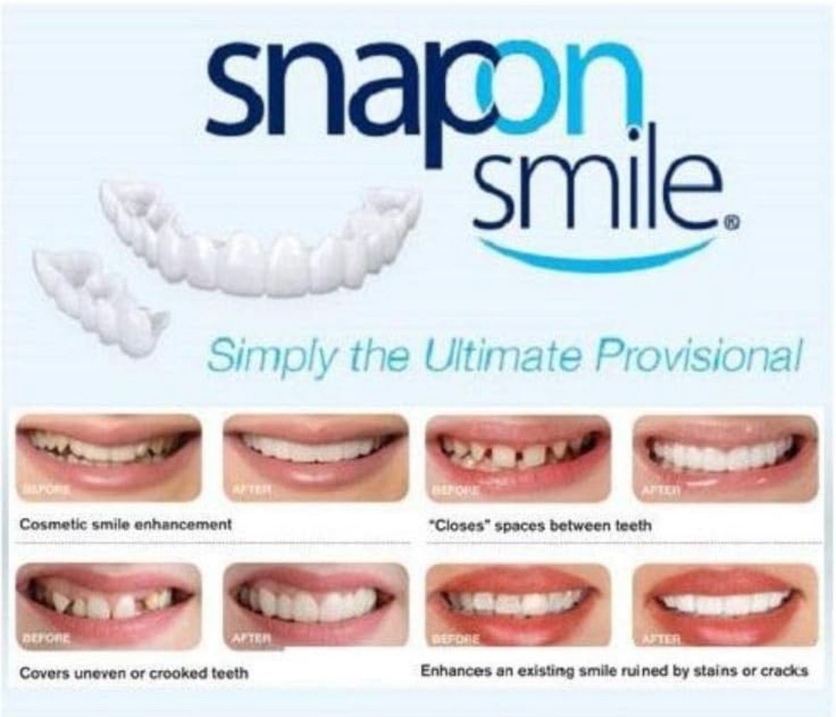 PROTESIS DENTAL REMOVIBLE