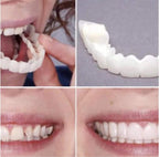 PROTESIS DENTAL REMOVIBLE