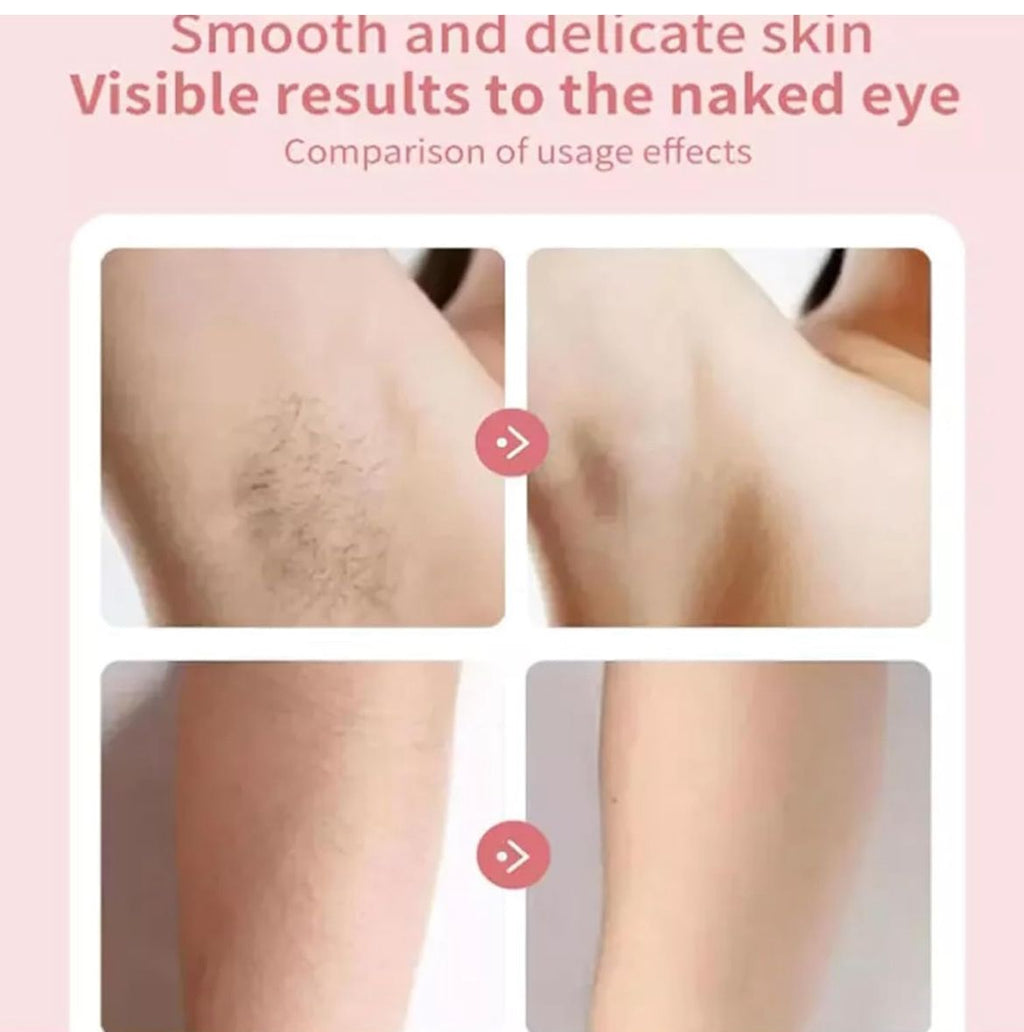 REMOVEDOR DE PELO PARA TODA AREA