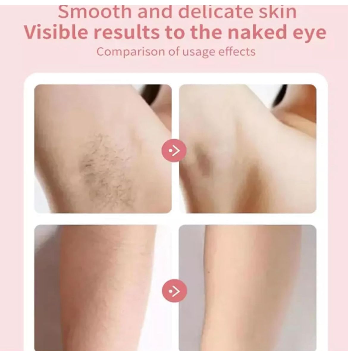 REMOVEDOR DE PELO PARA TODA AREA