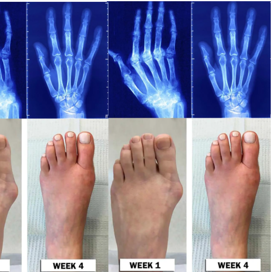 Crema Beevana Colageno Articulaciones