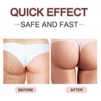 Parche de glúteos reafirmante