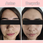 Serum 4 en 1 Antiarrugas y Manchas