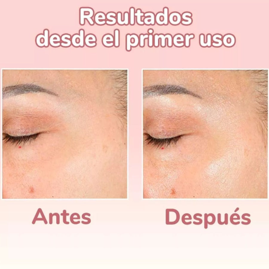 Serum 4 en 1 Antiarrugas y Manchas Para
