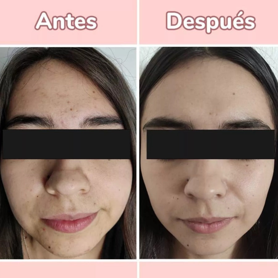 Serum 4 en 1 Antiarrugas y Manchas Para