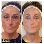 Serum de Caviar Antienvejecimiento