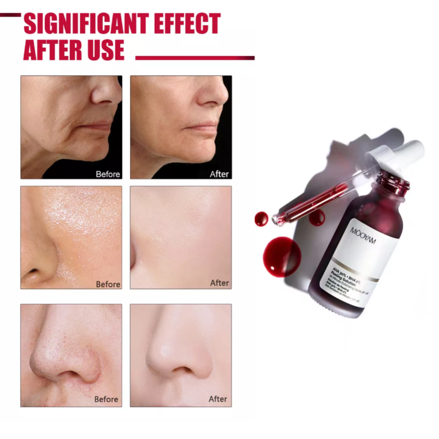Suero exfoliante Peeling Facial Manchas