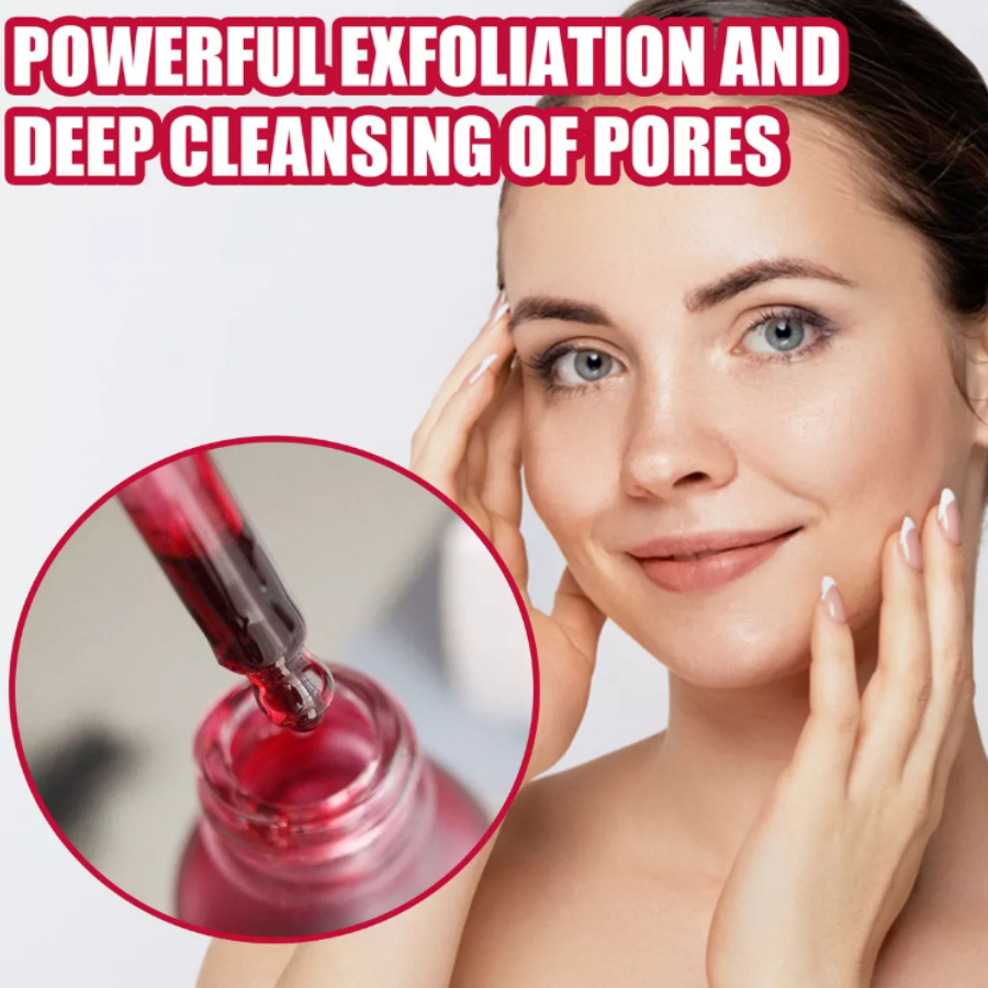 Suero exfoliante Peeling Facial Manchas