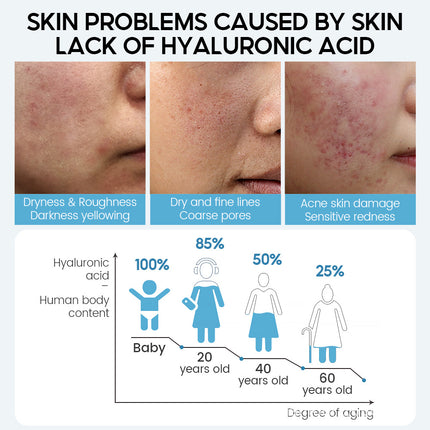 Sérum Facial de Ácido Hialurónico Antienvejecimiento Reductor de Poros Blanqueador Crema Hidratante Facial Cuidado Piel Seca