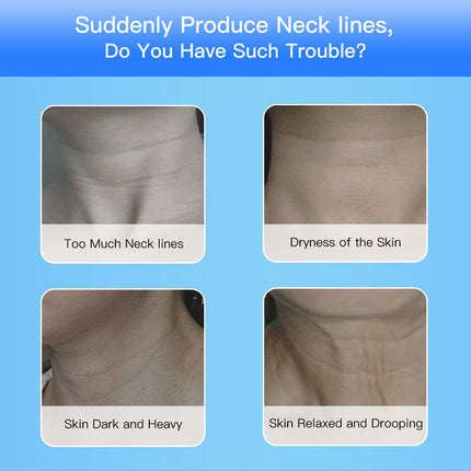 Dispositivo de belleza de cuello y cara por microcorriente EMS con terapia de fotones LED de 3 colores, para tensar la piel, reducir la papada, dispositivos de lifting facial