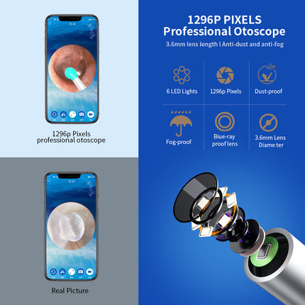 NE3 Limpiador de oídos Otoscopio Herramienta para quitar cera de oídos con cámara LED Luz inalámbrica Endoscopio para oídos Kit de limpieza de oídos para I-phone